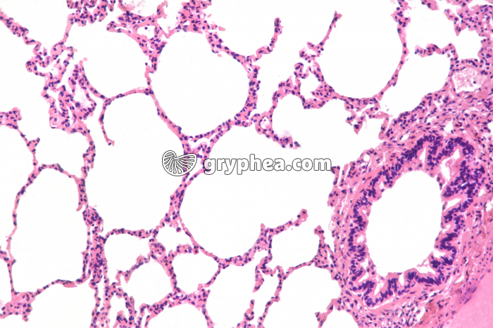 Poumon CT x40 - gryphea.com